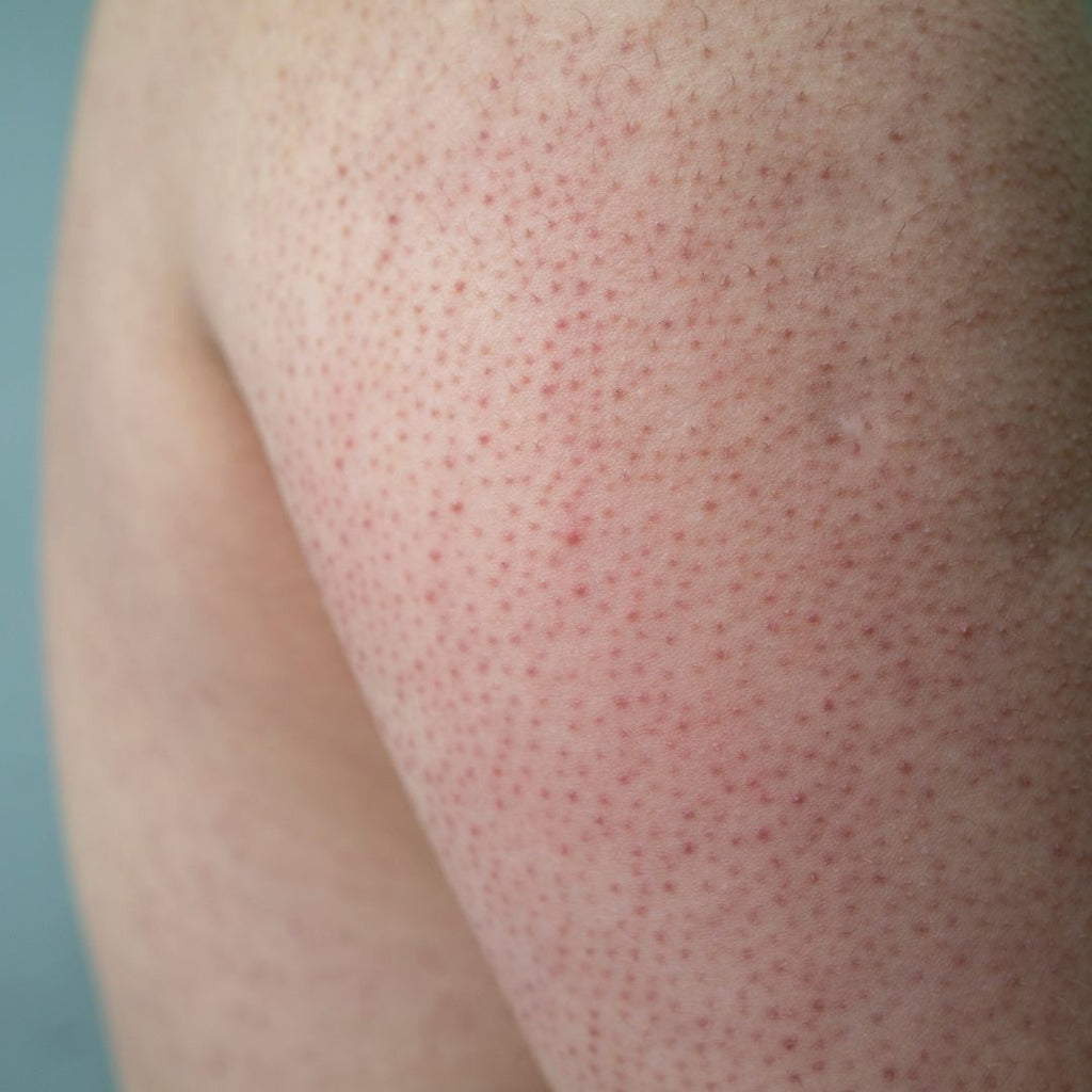 The Hidden Hazards of Sulfates and Parabens: Why Your Skin Deserves Better